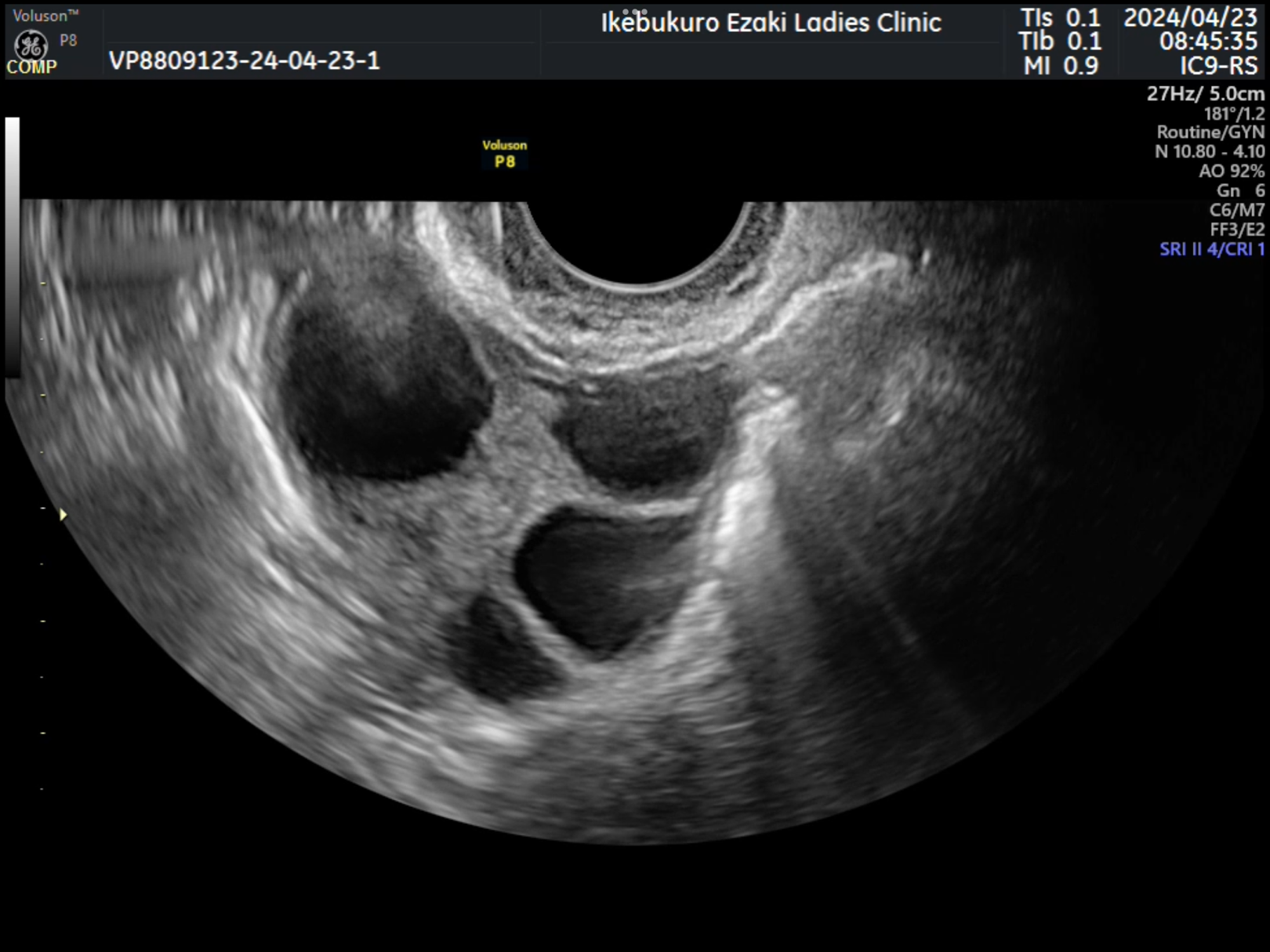 エコーガイド下局所麻酔法