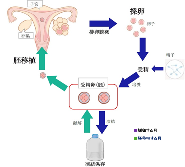 体外受精の流れ